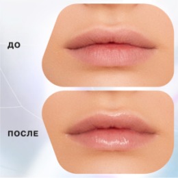 Influence Beauty Influence Beauty Маска для губ Volume dose/Lip mask